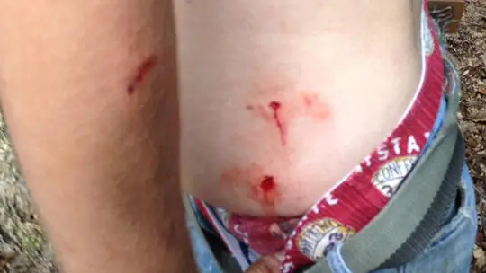 VIDEO : un chasseur attaqué par un ours