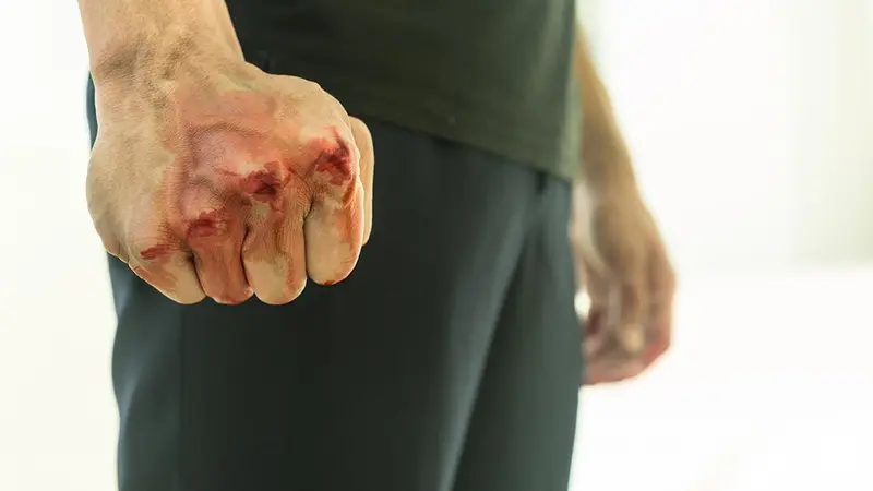 Violences faites aux chasseurs : les plaintes en hausse de près de 30% sur le total signalements