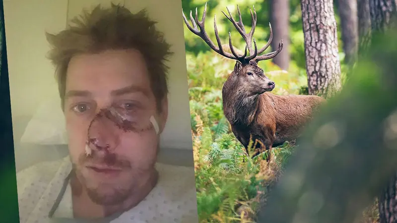 Un cerf blesse grièvement un traqueur dans les Landes