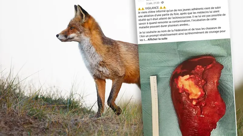 Un chasseur touché par l’échinococcose dans l’Ain