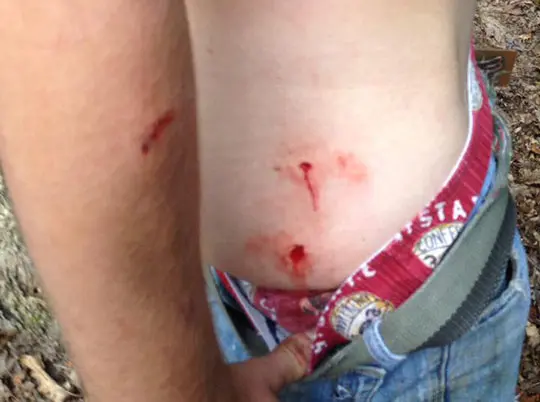 VIDEO : un chasseur attaqué par un ours