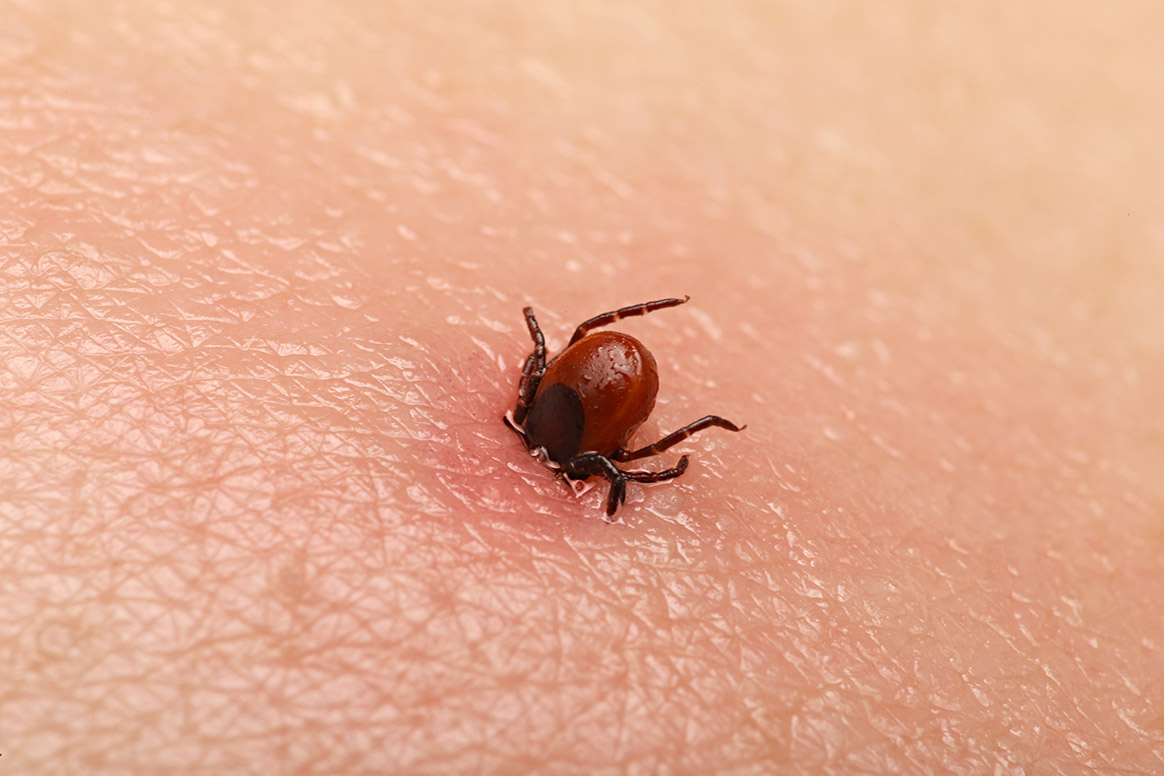 Un nouveau vaccin pourrait endiguer la propagation de la maladie de Lyme