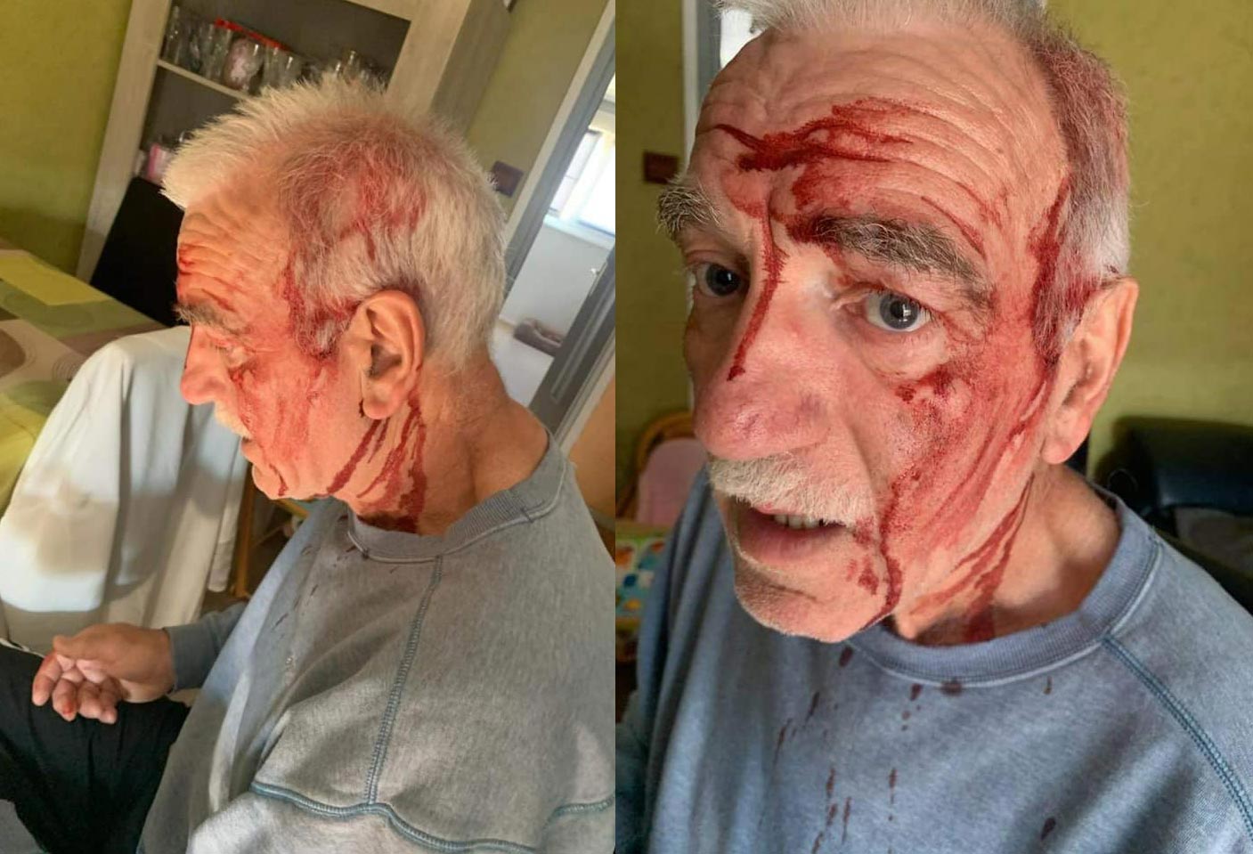 Alsace : un retraité attaqué par des corvidés