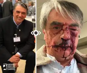 Le Président d&rsquo;une association de chasse tabassé près de ses miradors, la piste des anti-chasse étudiée