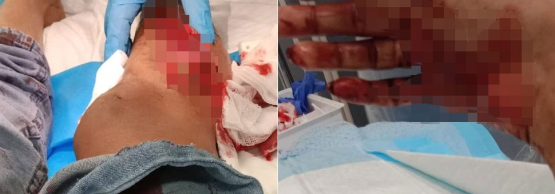 attaque de sanglier à singapour